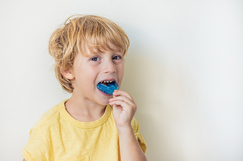 Mouthguards Townsville | North Queensland Family Dental